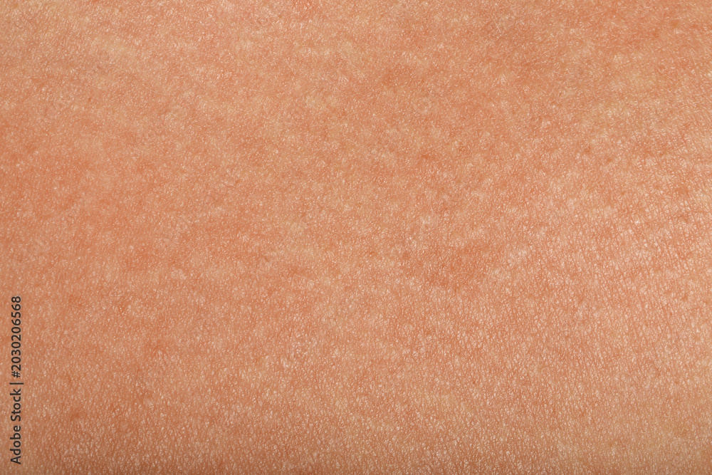 Fototapeta premium Texture of normal skin as background, closeup