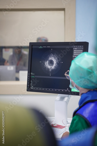 Electrophysiology study monitoring in hospital