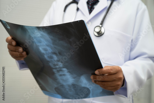 Canvastavla Doctor examining spine bone radiography xray film.