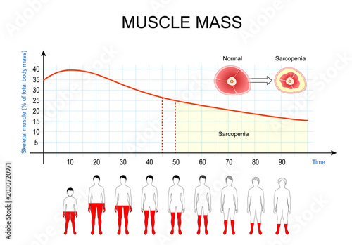 Sarcopenia and age-related muscle loss. Aging anatomy, longitudinal chart of skeletal muscle degeneration
