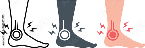 Human ankle pain vector illustration showing inflammation and sprain discomfort for medical, healthcare, and anatomy education design