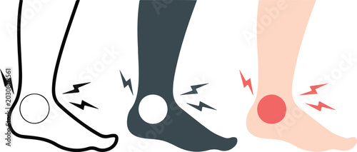 Human ankle pain vector illustration showing inflammation and sprain discomfort for medical, healthcare, and anatomy education design