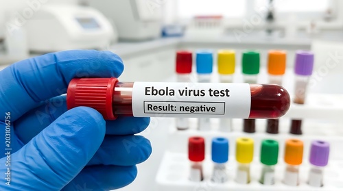 Hand in blue glove holding blood sample test tube labeled Ebola virus test result negative in laboratory setting with other samples.