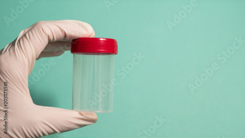 Quadro su tela Gloved Hand Holding Empty Specimen Container with Red Cap — Medical Sample Colle