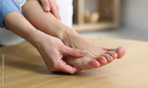 Schilderij op canvas Woman with callus on her toe at home, closeup