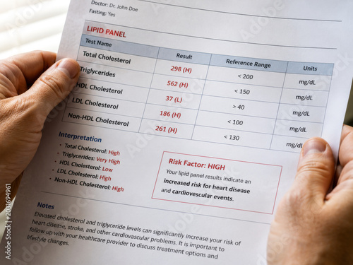 Close-up of a person's hands carefully holding and reviewing a detailed lipid panel medical report, showing high cholesterol and triglyceride levels with an increased risk factor for heart disease, is