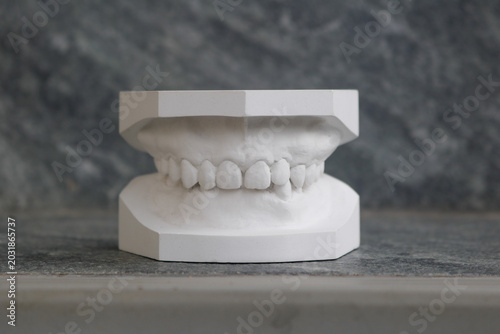 A White Gypsum Plaster Dental Cast Model Showing Upper and Lower Teeth Occlusion Placed Separately on an Outdoor Grey Concrete Stone Surface Background