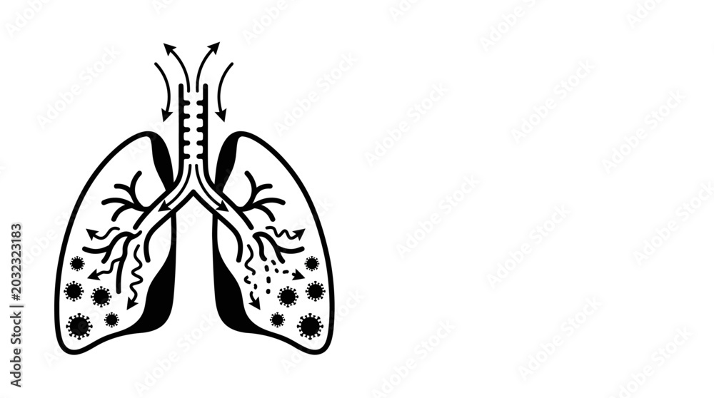 Αυτοκόλλητο Illustration of Human Lungs Infected with Virus or Bacteria.