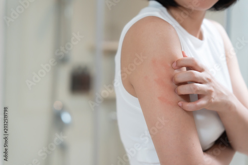 Canvas Print skin problem and beauty