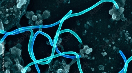 Foto Scanning electron micrograph of marburg virus particles