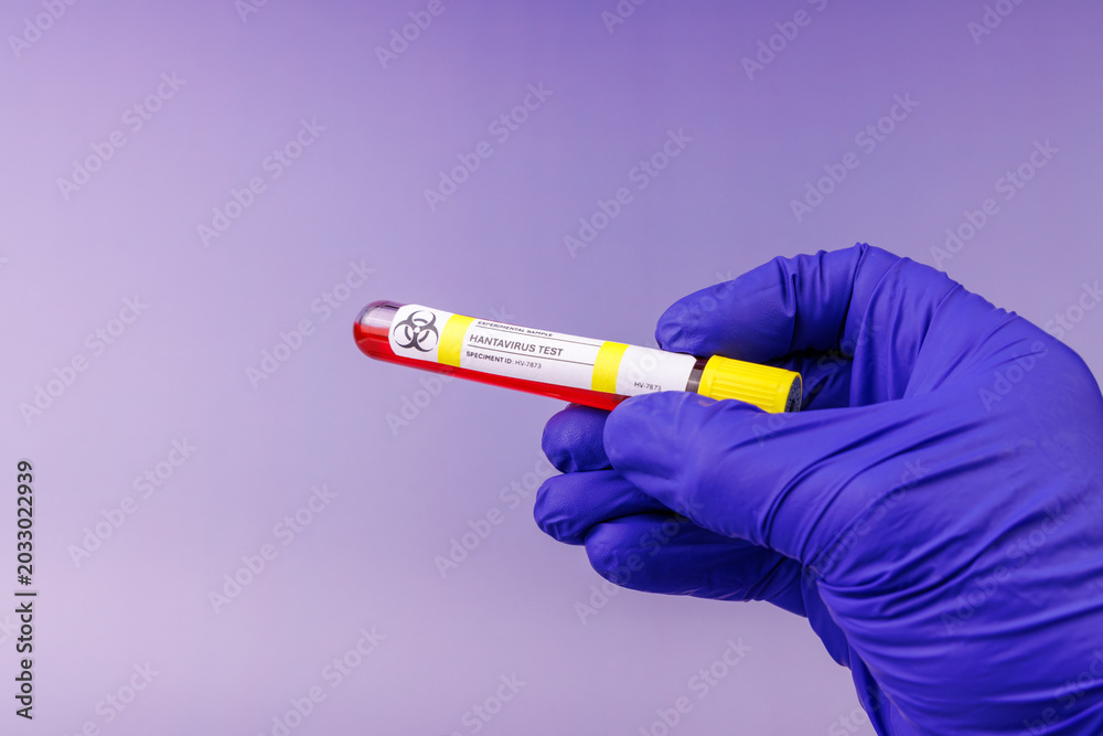 Obraz premium Gloved hand in blue holding a vibrant red hantavirus sample in a test tube on a violet gradient background for microbiology work.
