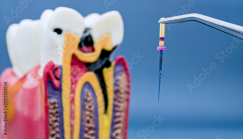 Tableau sur toile Macro view of endodontic rotary file in tweezers with blurred cross-section tooth model in background
