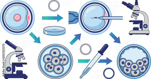 Photos In Vitro Fertilization IVF Process Diagram Vector Icon Set Showing Ovum Injectio