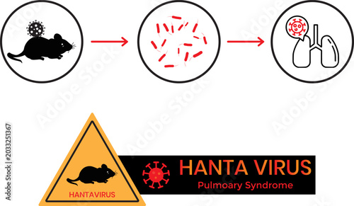 Transmission and Impact of Hantavirus Pulmonary Syndrome