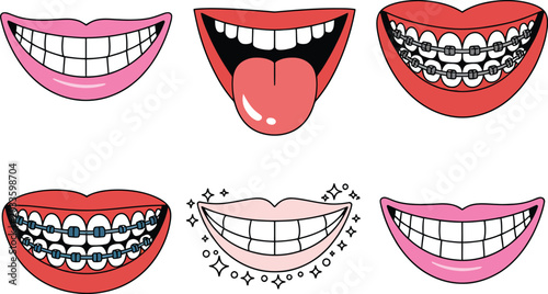 Bild auf Leinwand smiling mouth, teeth braces tongue and lips vector isolated playful dental backg
