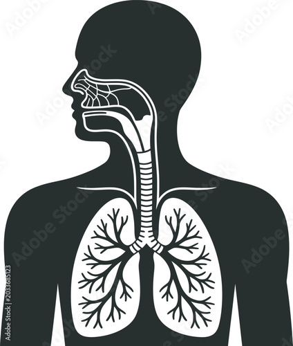 Cuadro en lienzo human silhouette with inflamed respiratory system, lungs showing diseases like a