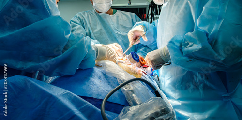 Focused surgeon using metal tweezers and clamps during delicate surgical intervention in hospital.