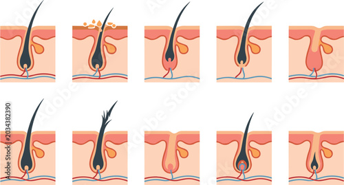 Photos Human Hair Follicle Anatomy and Growth Cycle Vector Icon Set Showing Anagen Cata