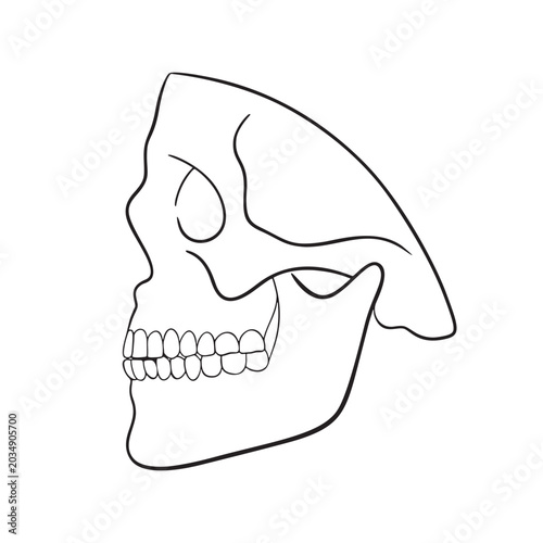 Crossbite Illustration