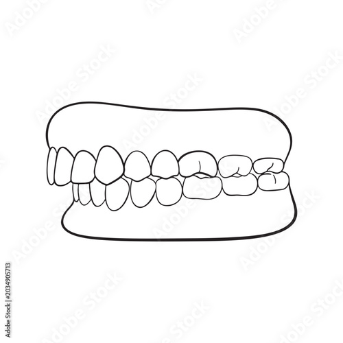Malocclusion Illustration