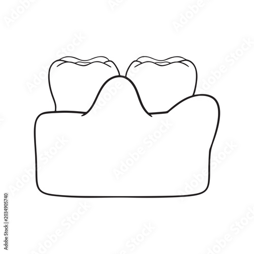 Swollen gums Illustration