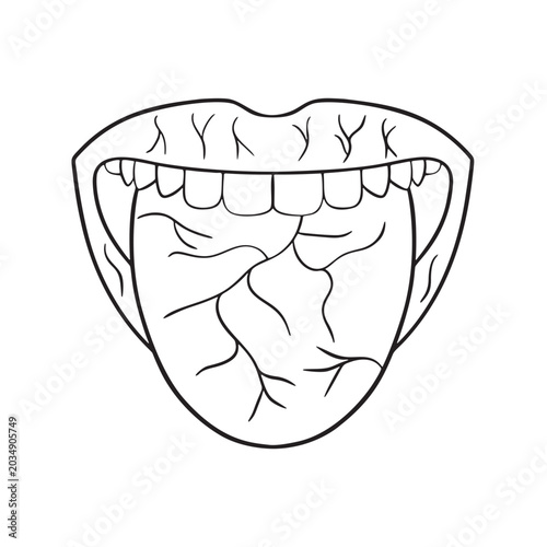 Dry Mouth Illustration