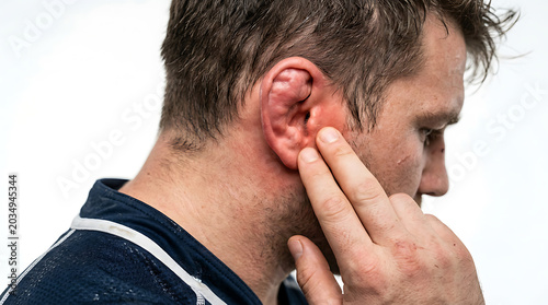 Man experiencing ear pain, infection, or inflammation. Red, swollen outer ear. Medical condition, healthcare, health issue.