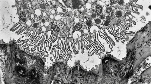 TEM of osteoclast ruffled border at bone resorption lacuna