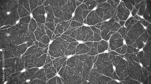 Confocal reflectance micrograph of corneal stroma interconnected keratocytes network