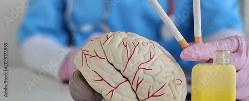 Fotografie Medical demonstration of brain model alongside smoking cessation tools