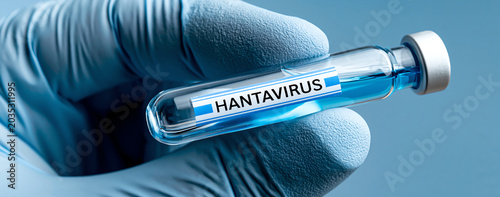 Hantavirus illustration, AI generated