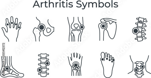 Fényképezés Arthritis symptoms and affected joints illustrations