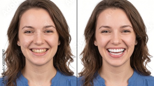 Smiling woman before and after teeth whitening, showcasing a bright, healthy smile and improved confidence in a split-screen portrait