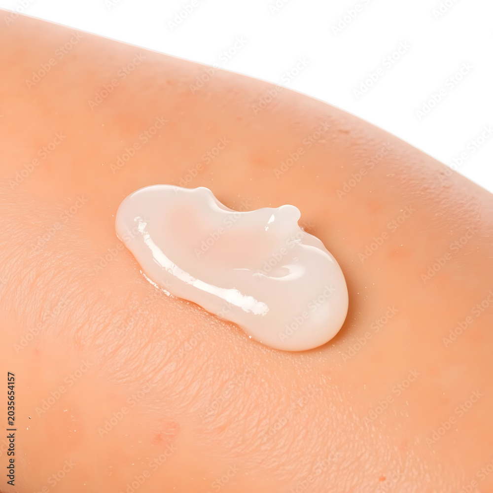 Fototapeta premium Aloe vera gel applied to sunburned skin