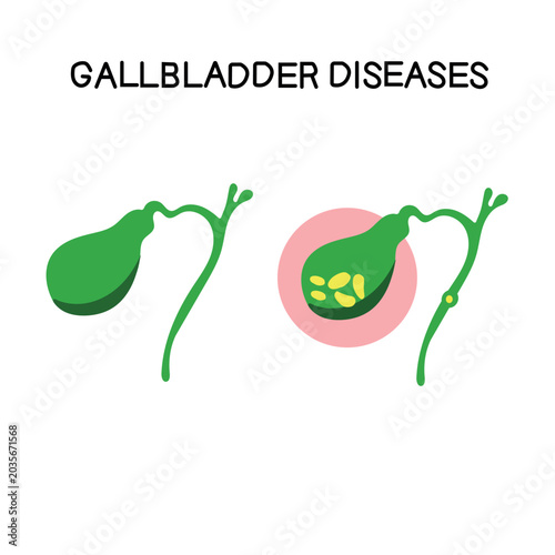 Flat vector digestive health and gallbladder disorder vector