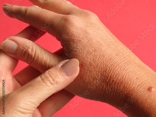 Fotografia Closeup of woman hand with dark spots on pink background