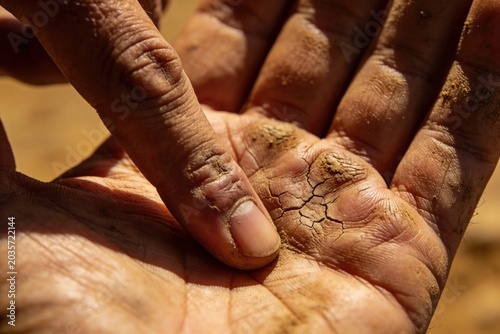 The Callous Trace, Appreciating Sacrifice, Close-Up of a Hand with Cracked Skin in a Dry Environment