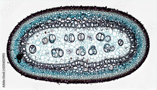 Cinematic Commercial Science Image of Darkened Xylem Vessels and Hyphae Blockage 4K