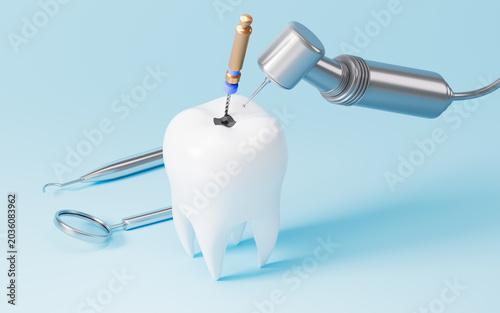 Human teeth root canal treatment process. 3d rendering.