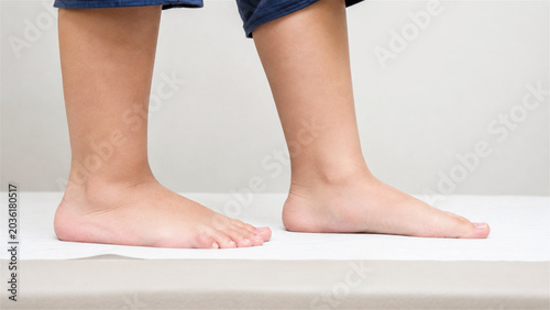 child feet standing on medical examination paper in clinic. Podiatrist checkup of flat foot or flatfoot posture. Orthopedic diagnosis for development of healthy gait and support