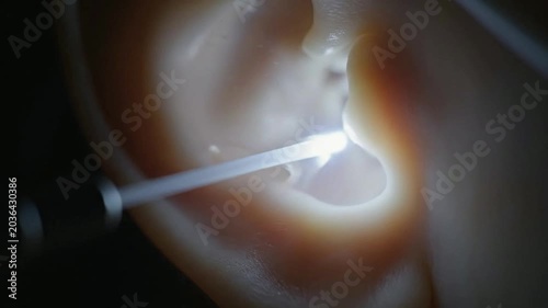 Detailed Close-Up Examination Of Ear Canal With Otoscope And Light During Medical Inspection For Health Evaluation