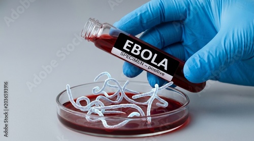 Ebola virus specimen in a test tube and petri dish