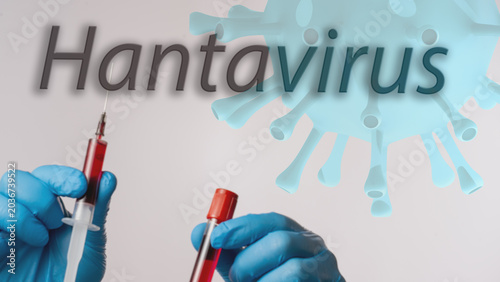 Foto Blue-gloved hands hold a syringe and vial