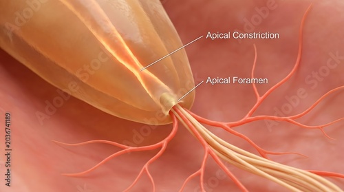 Dental root tip showing apical constriction and foramen with spreading nerve bundle