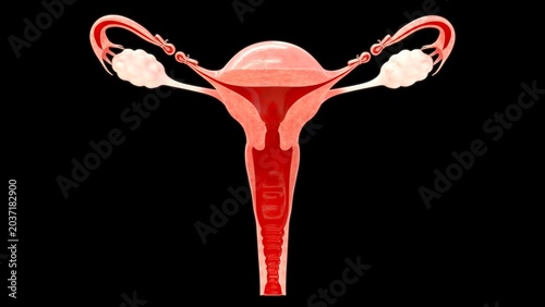 Tubal Ligation Surgical Procedure Illustration