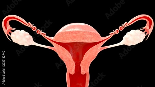 Bild auf Leinwand Tubal Ligation Surgical Procedure Illustration