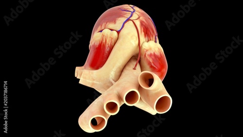 Obraz na płótnie Coronary artery bypass grafting (CABG) is a major surgical procedure used to treat severe coronary artery disease