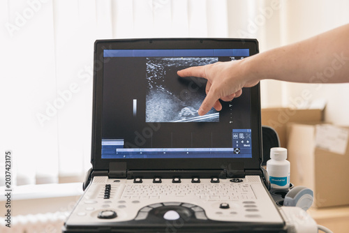Hand pointing on ultrasound screen for medical diagnosis in a healthcare clinic