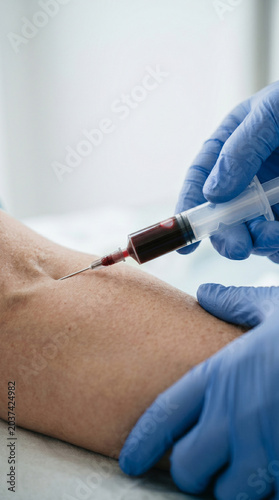 Extreme close-up of a nurse's hand taking a patient's blood sample from a vein with a syringe in a clinic, minimalist medical procedure