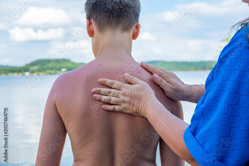 Child standing seaside blue lake water, adult hand applies sunscreen on chest, rear shirtless boy, calm waters beach background, skin protection, parenting care, sun safety during family vacation